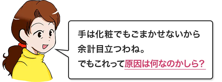手は化粧でもごまかせないから余計目立つわね。でもこれって原因は何なのかしら？